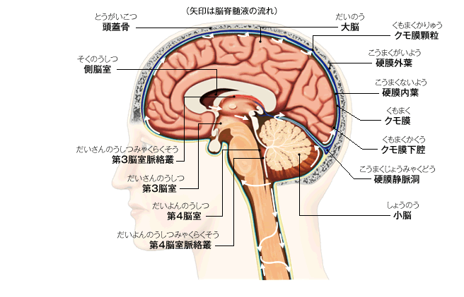 頭痛といえば 山村クリニック（広島市中区 | 脳神経外科）- 脳卒中（脳 ...