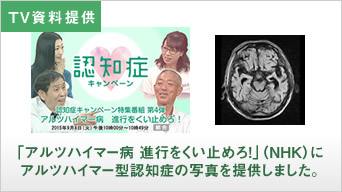 NHK特番にMRI写真を提供しました。